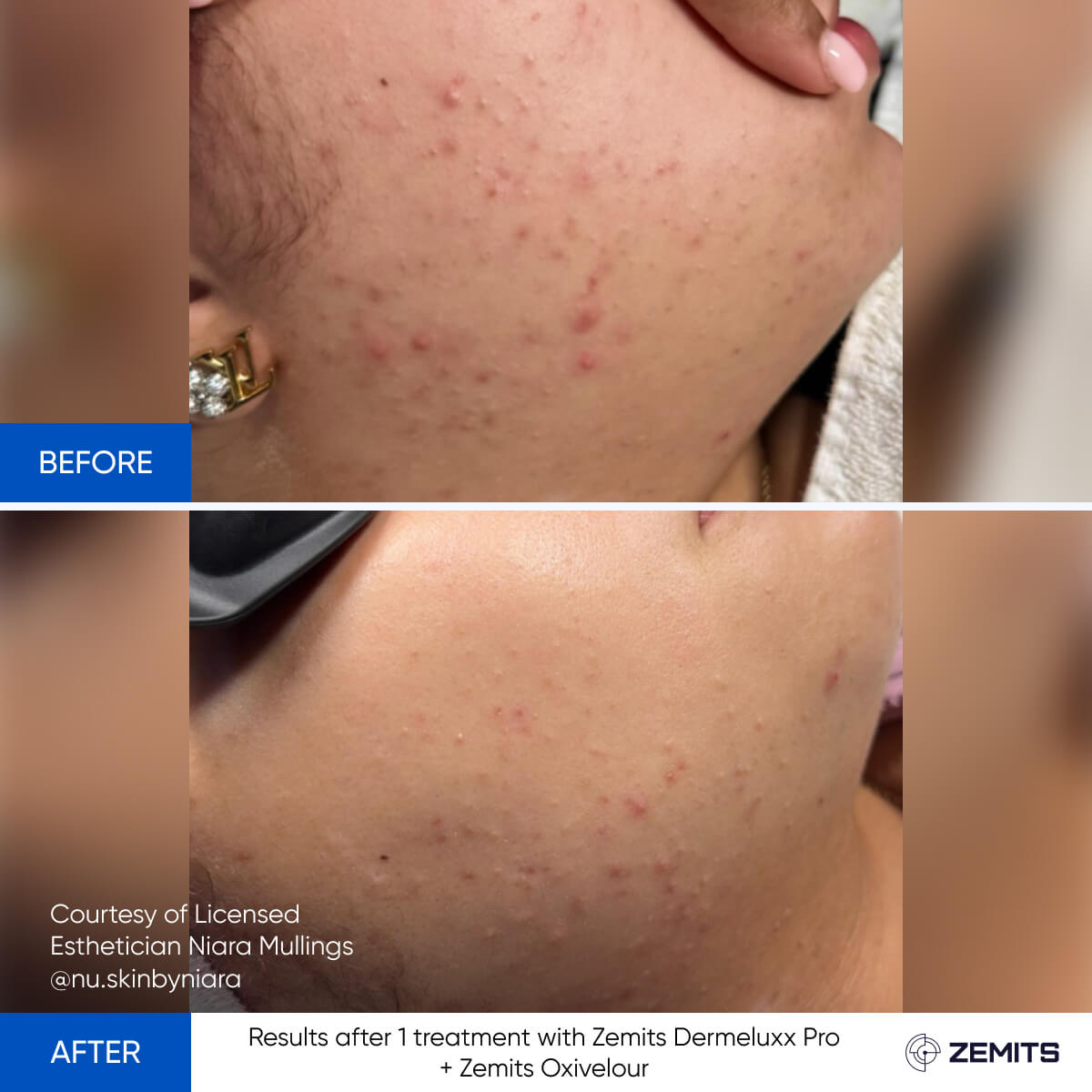 Before After Slide 13