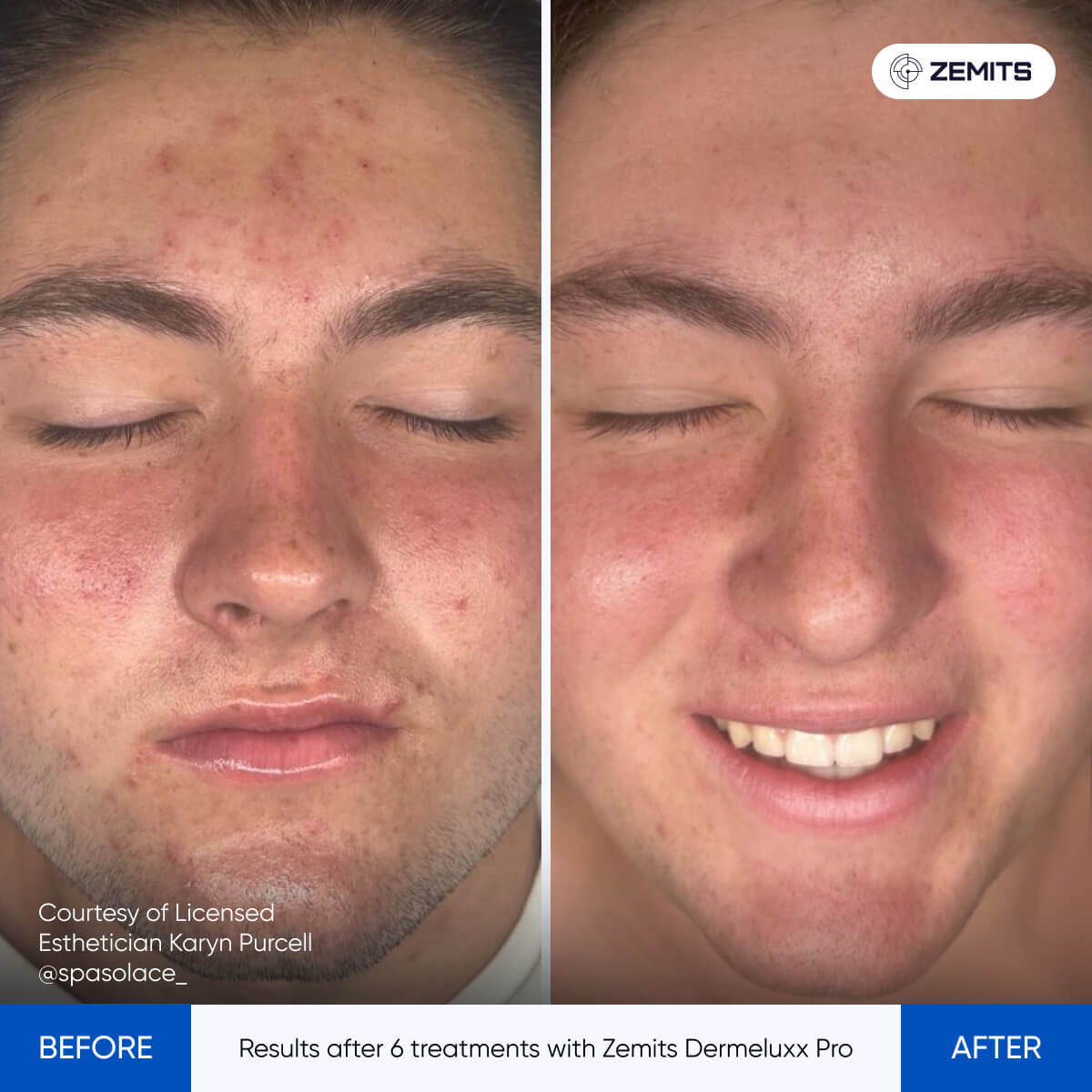 Before After Slide 15