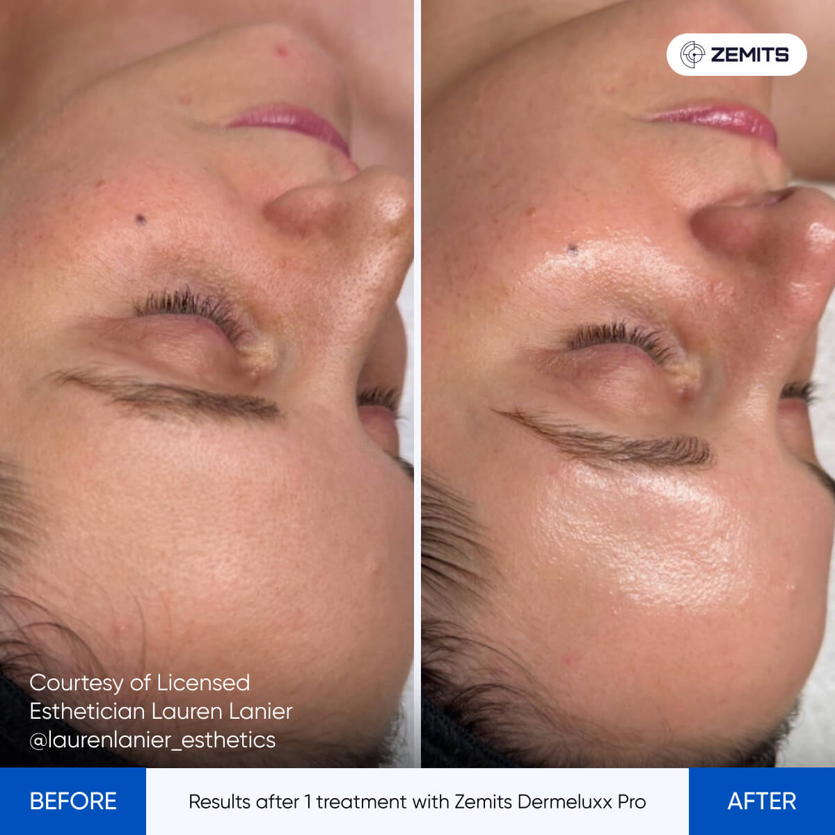 Before After Slide 21