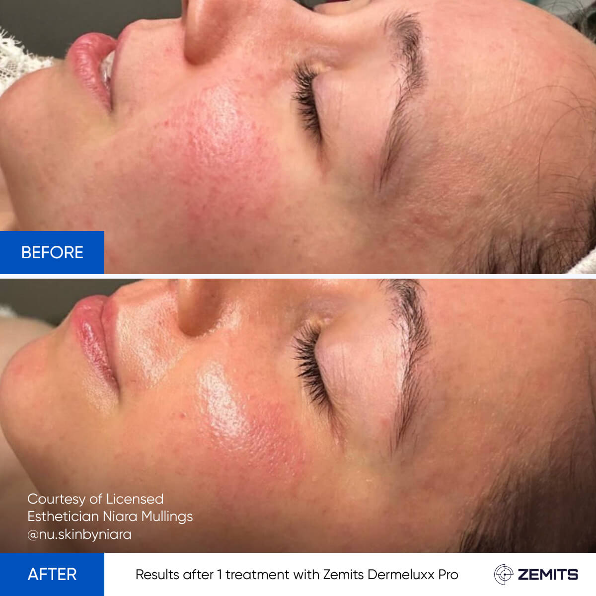 Before After Slide 16
