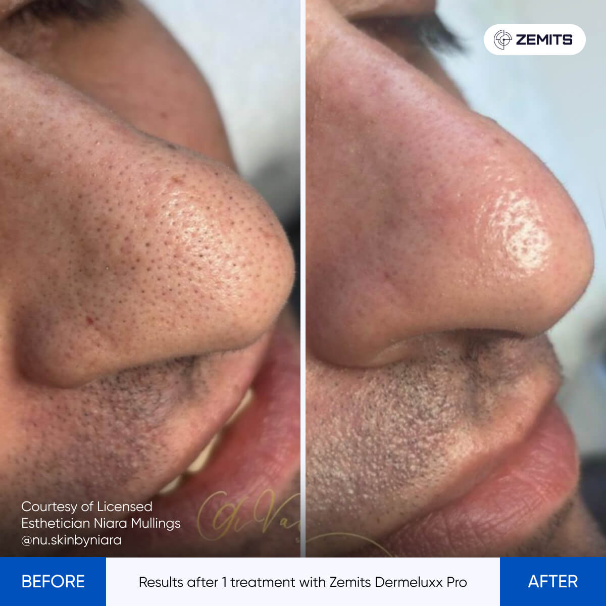 Before After Slide 22