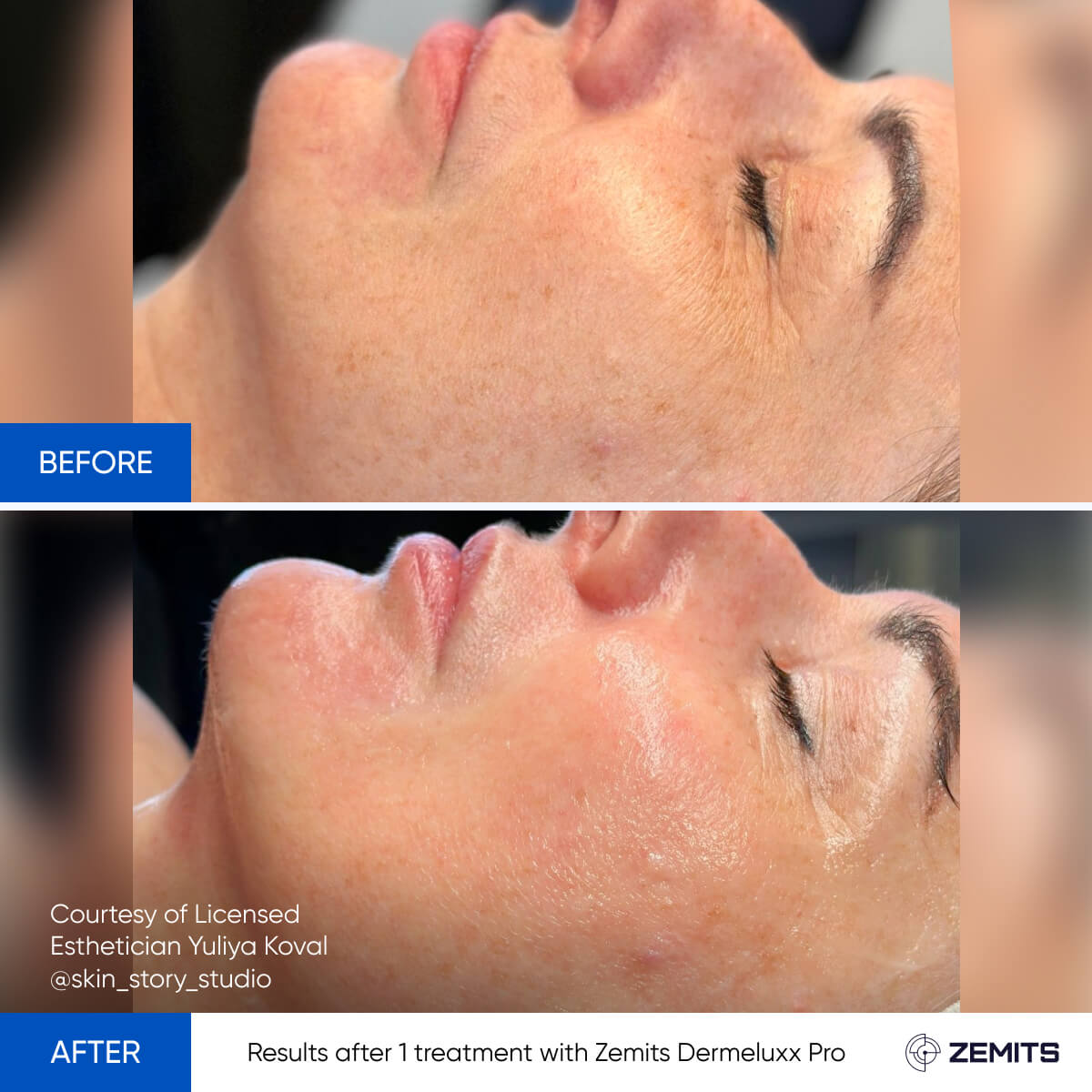 Before After Slide 17