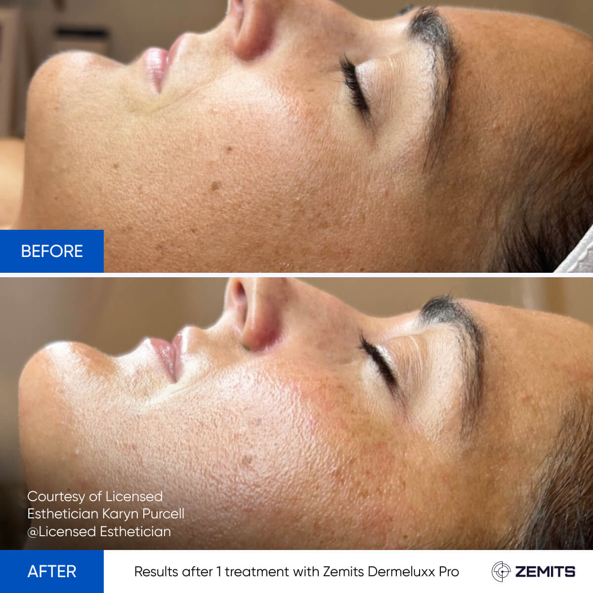Before After Slide 23