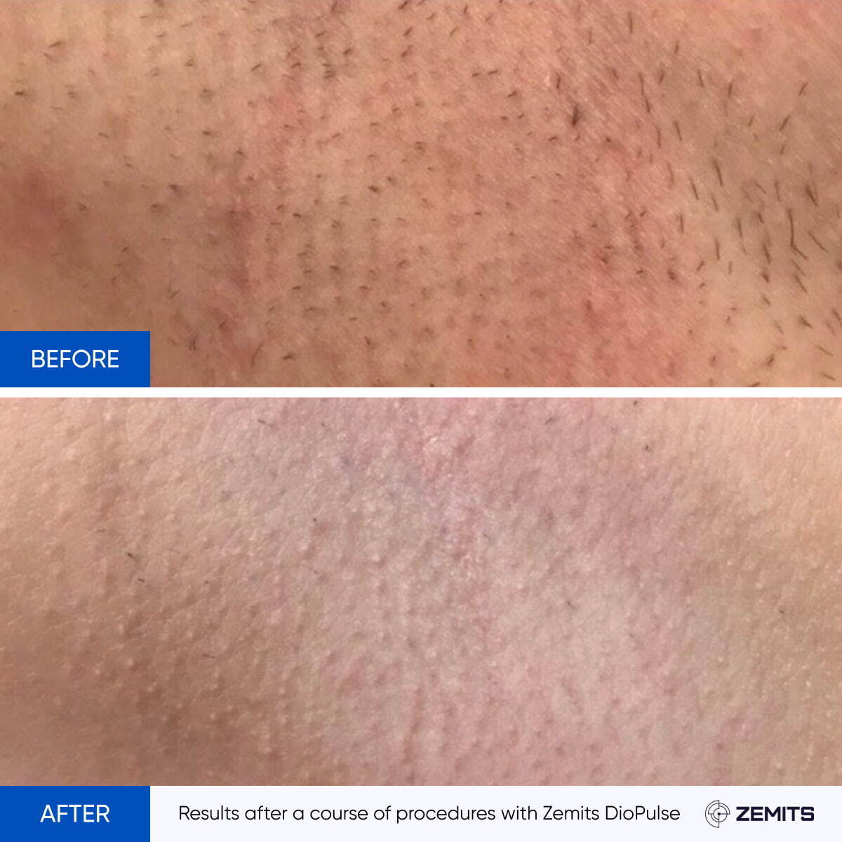 Before After Slide 3