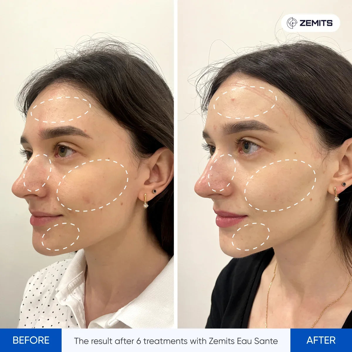 Before After Slide 5