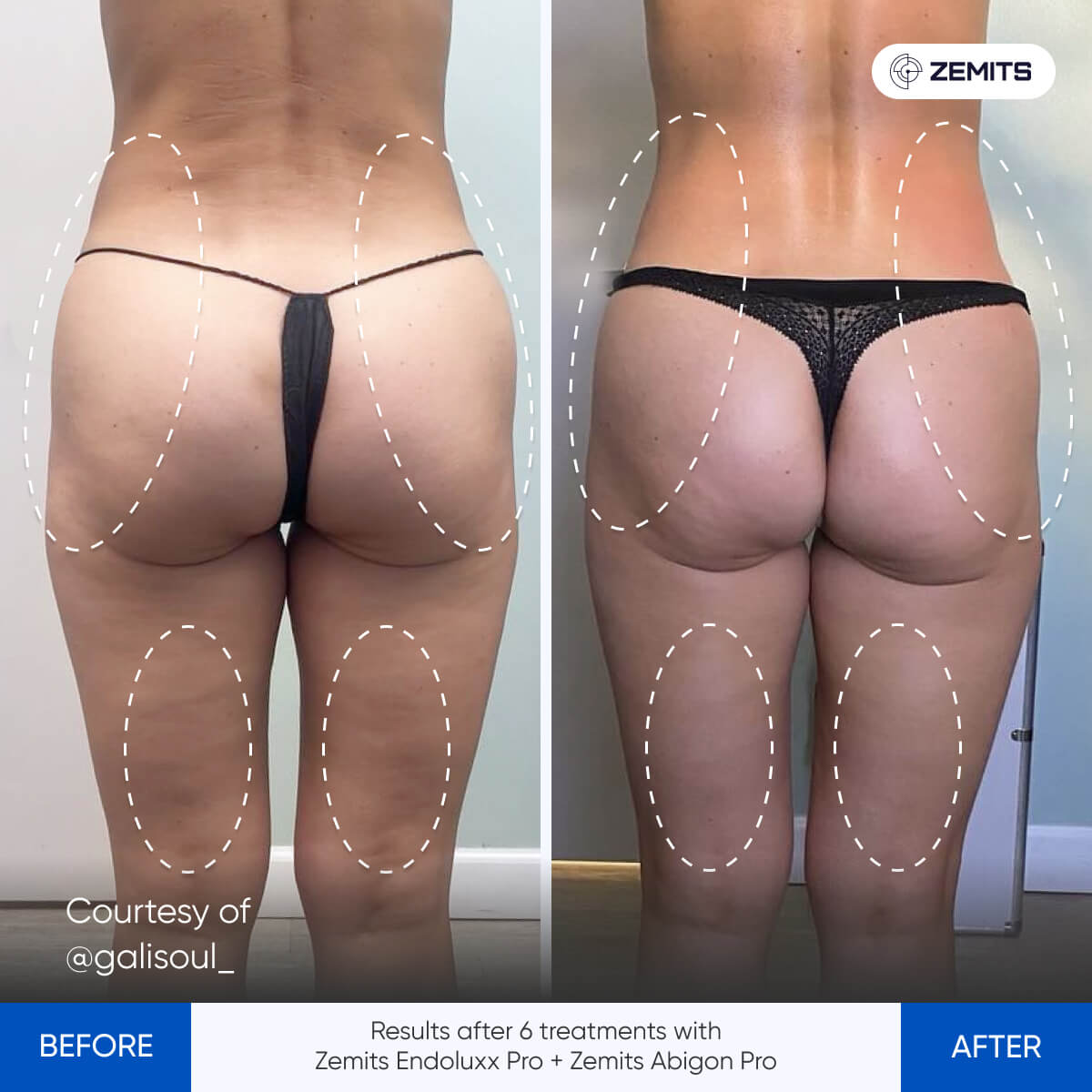 Before After Slide 3