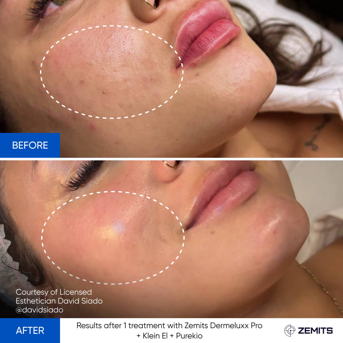 Before After Slide 3