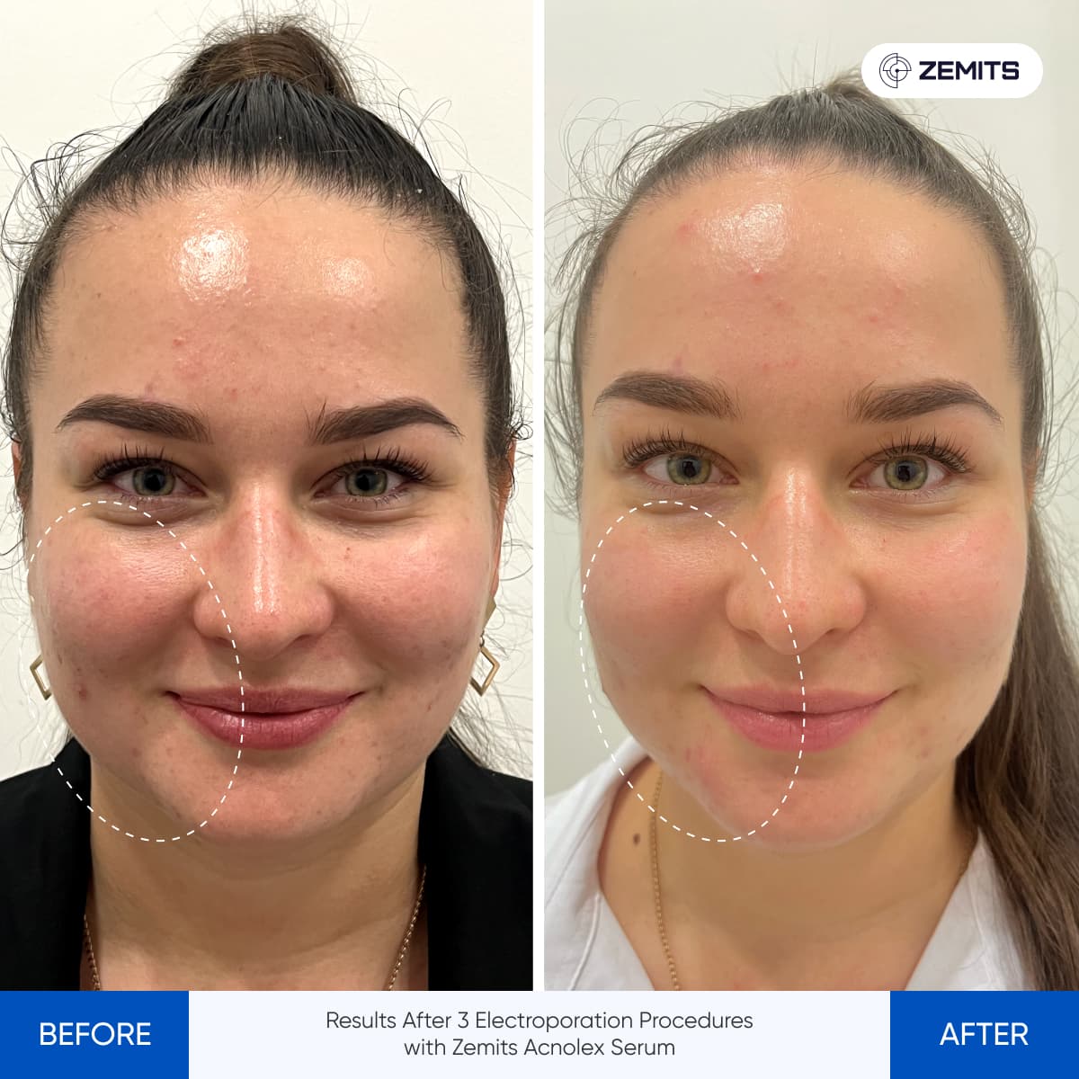 Before After Slide 4