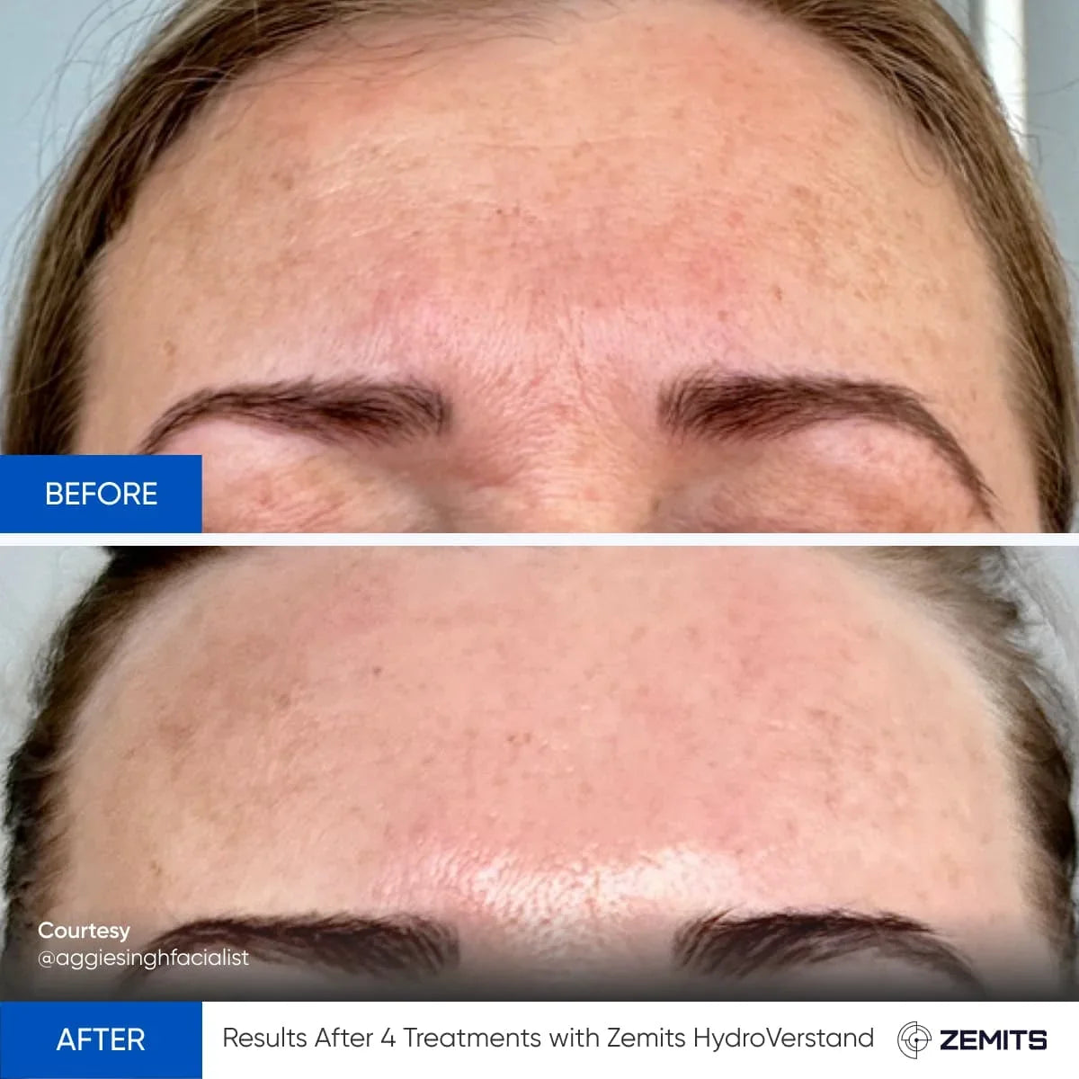 Before After Slide 4