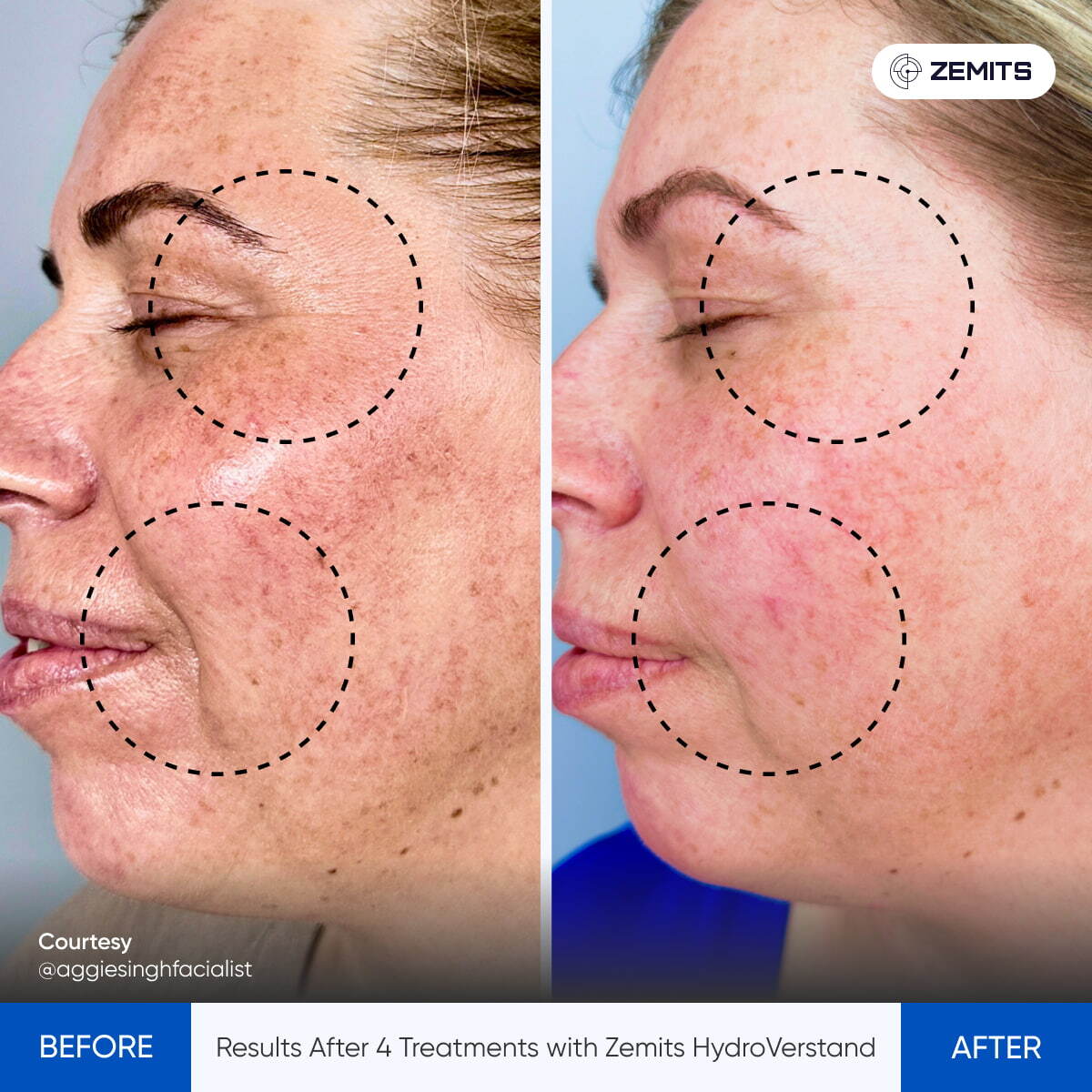 Before After Slide 3