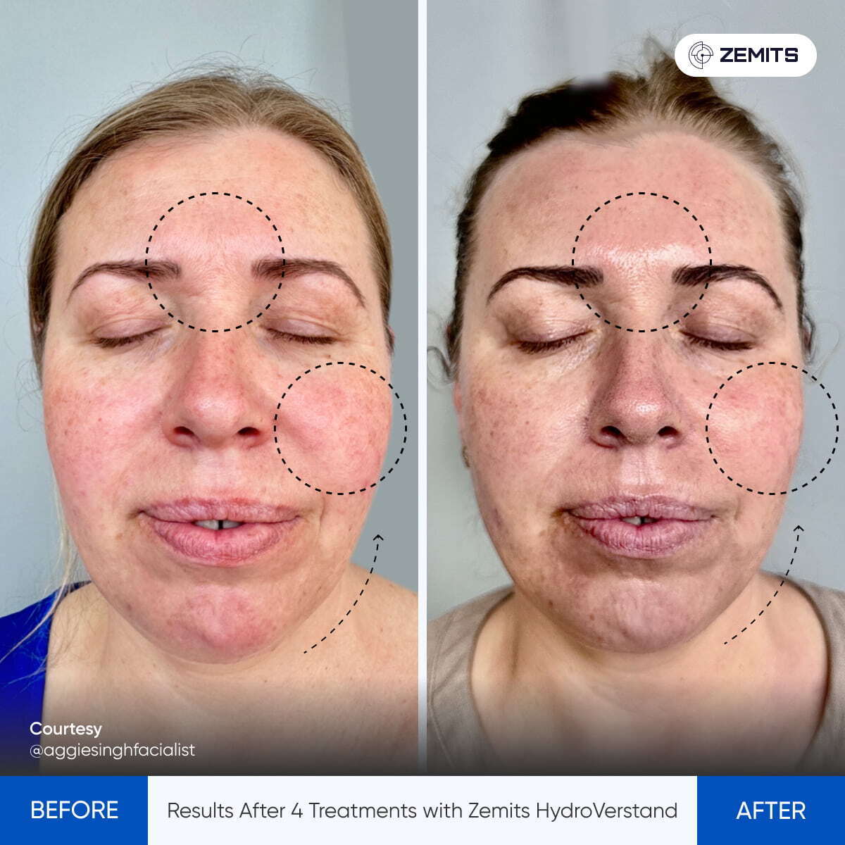 Before After Slide 7