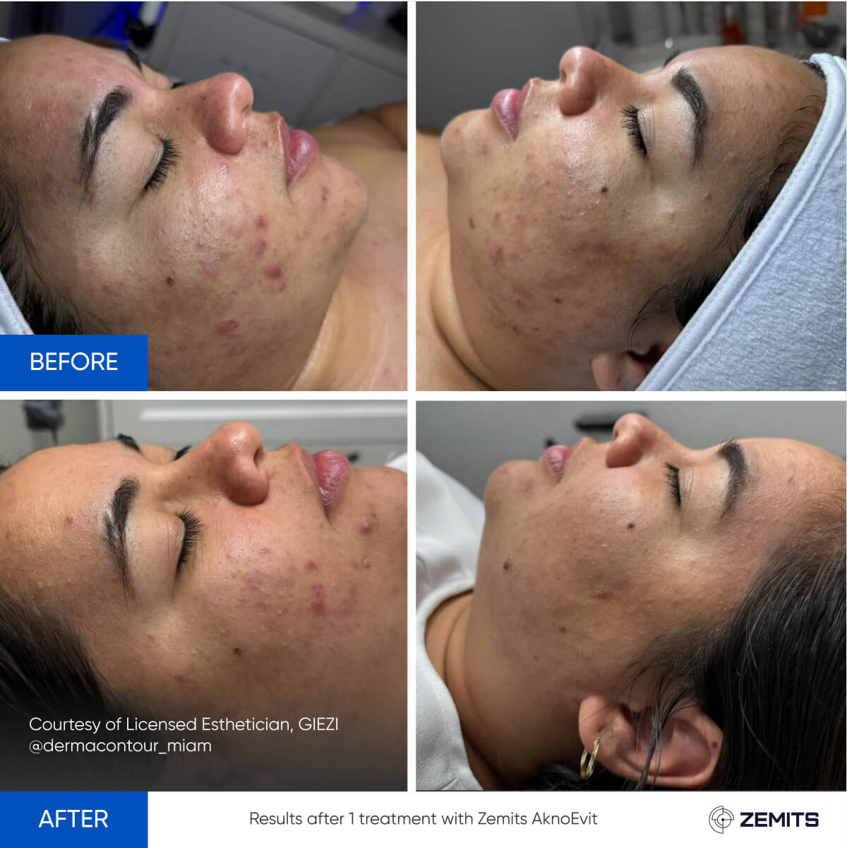 Before After Slide 1