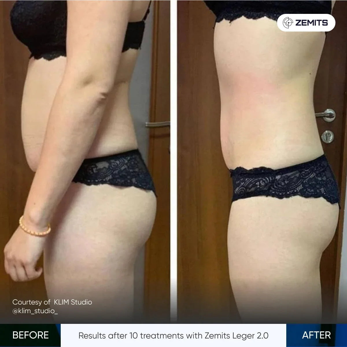 Before After Slide 3
