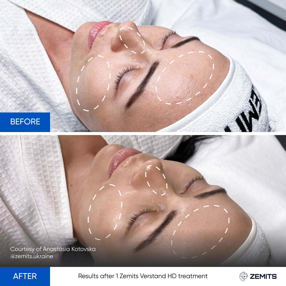 Before After Slide 3