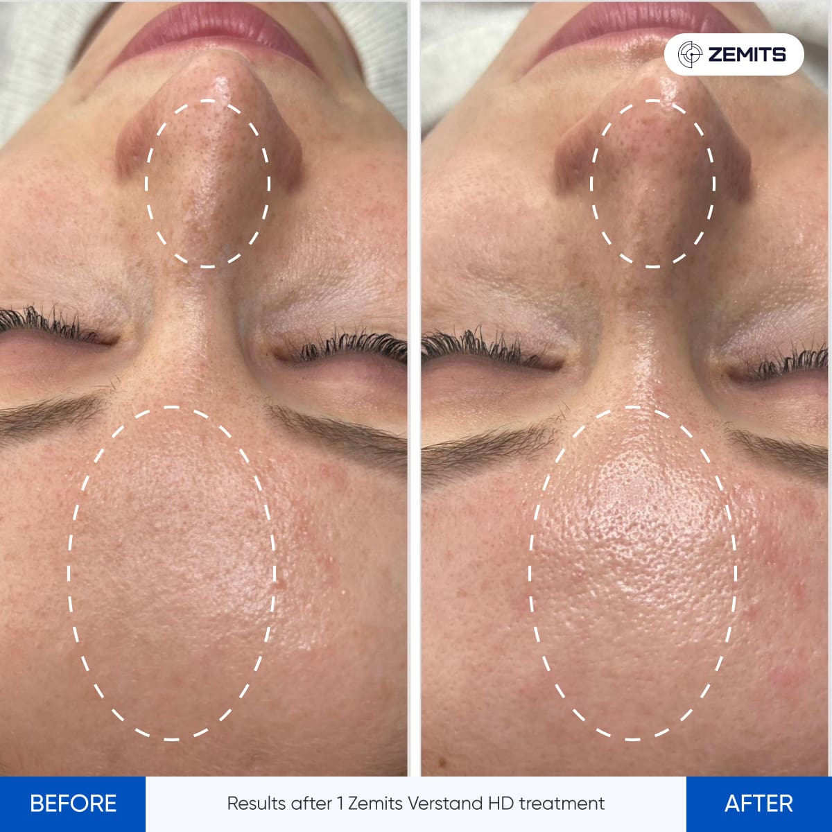 Before After Slide 4