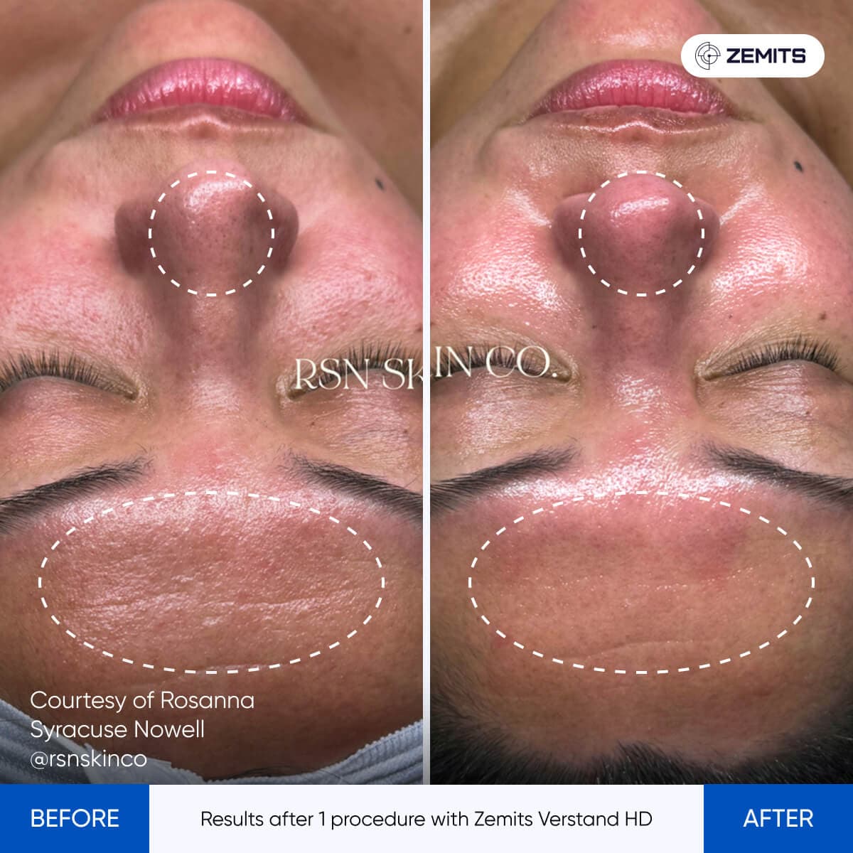 Before After Slide 8