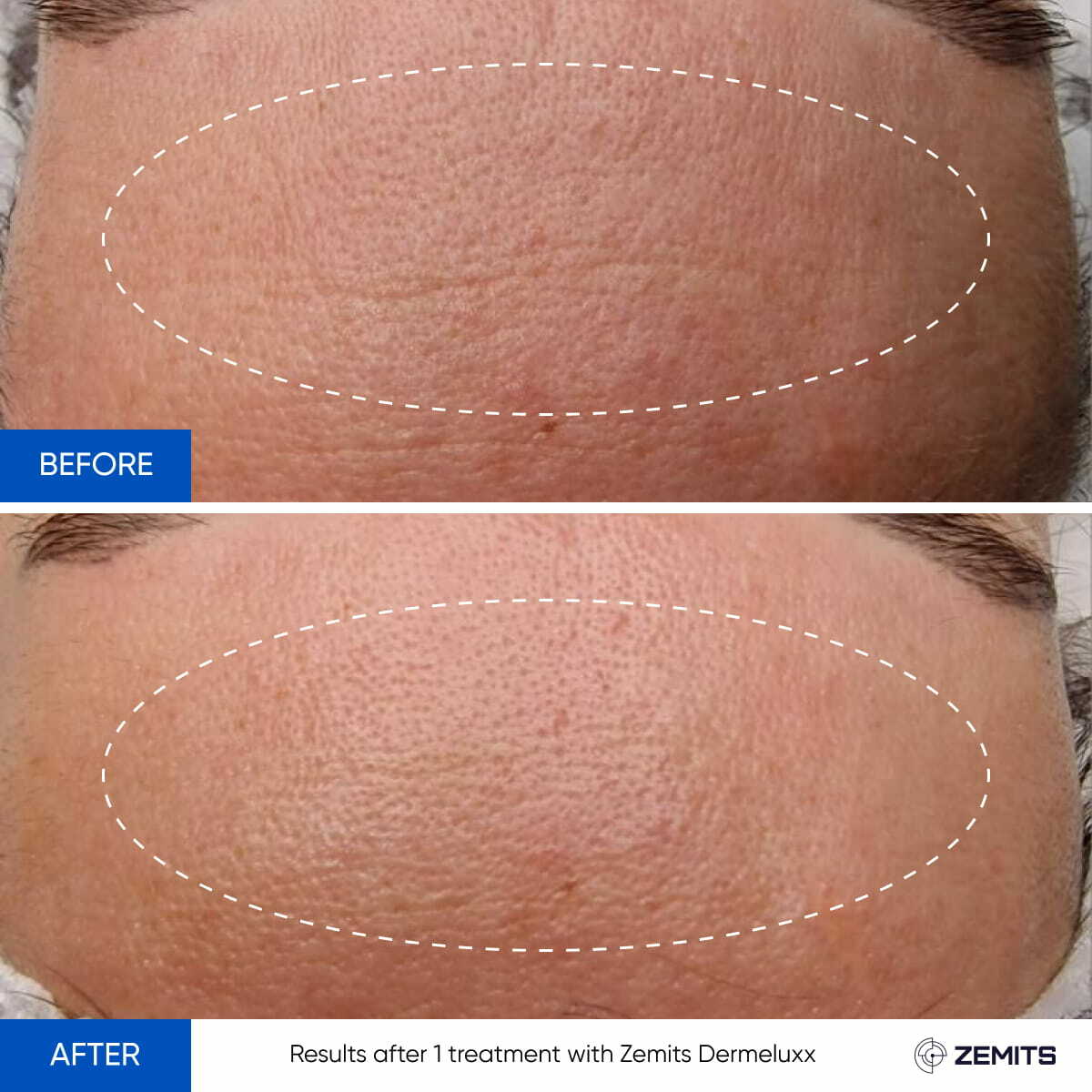 Before After Slide 4