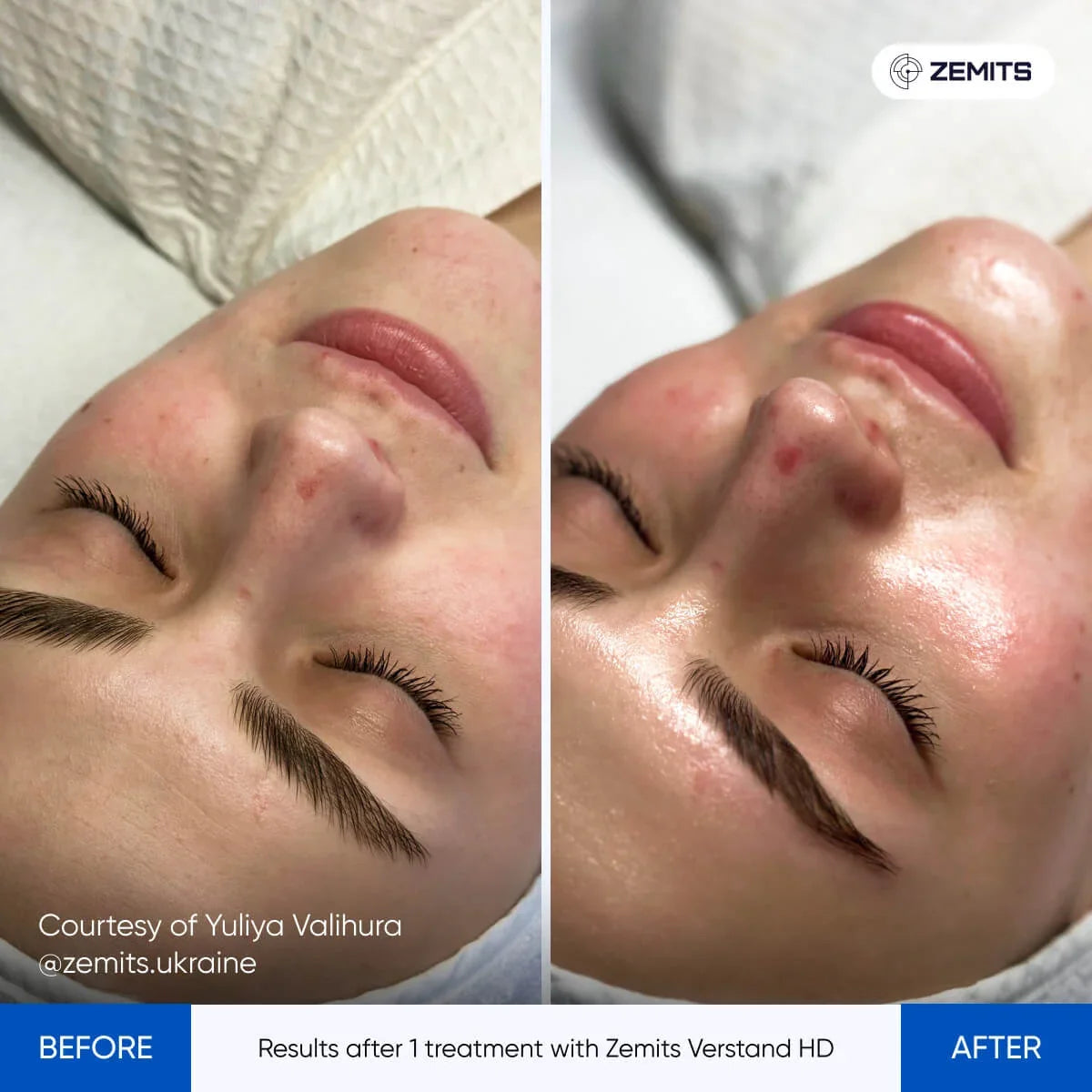 Before After Slide 6