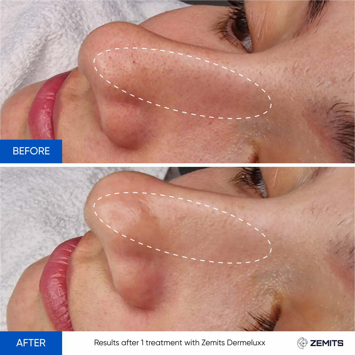 Before After Slide 3