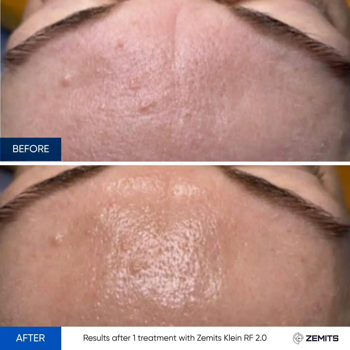 Before After Slide 9