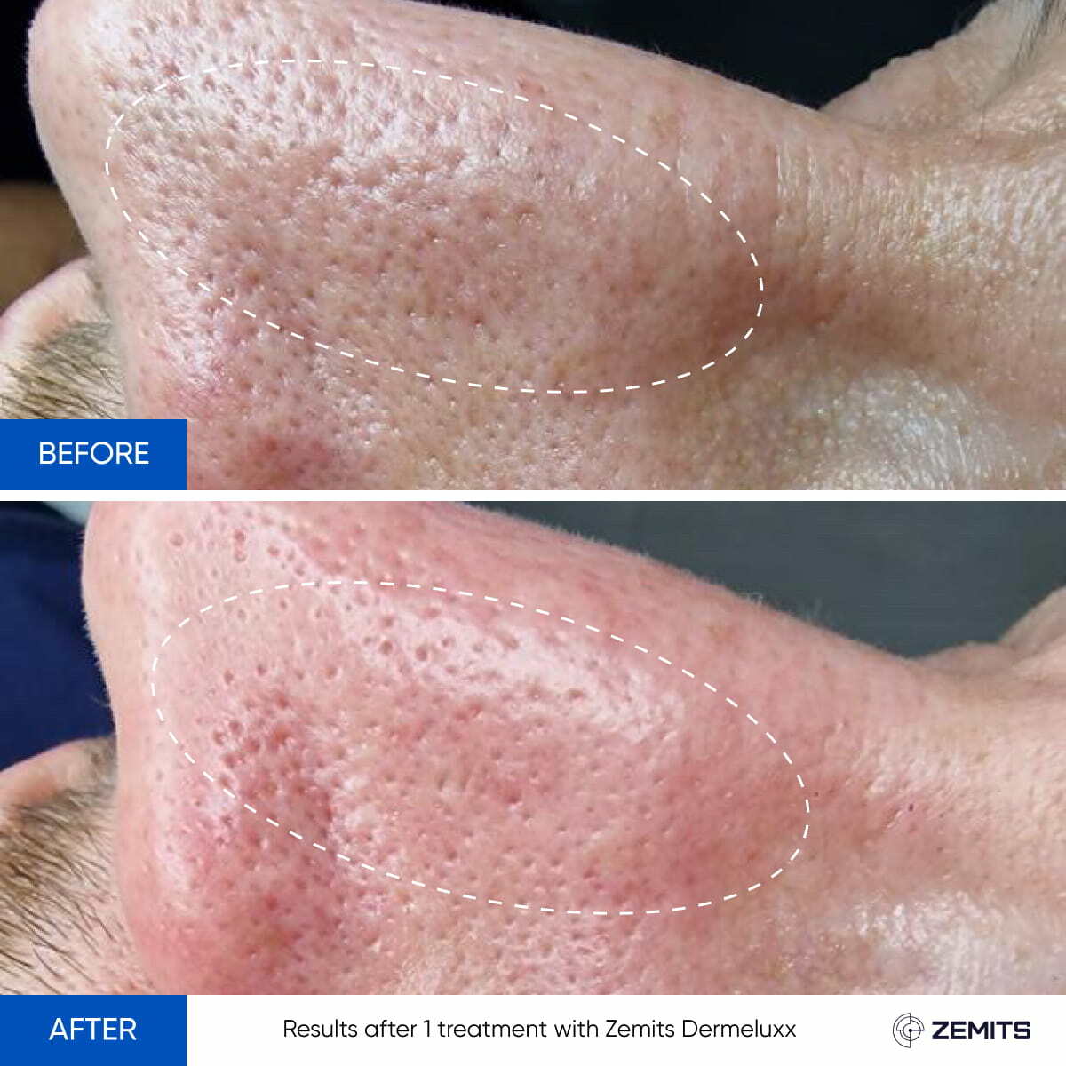 Before After Slide 2