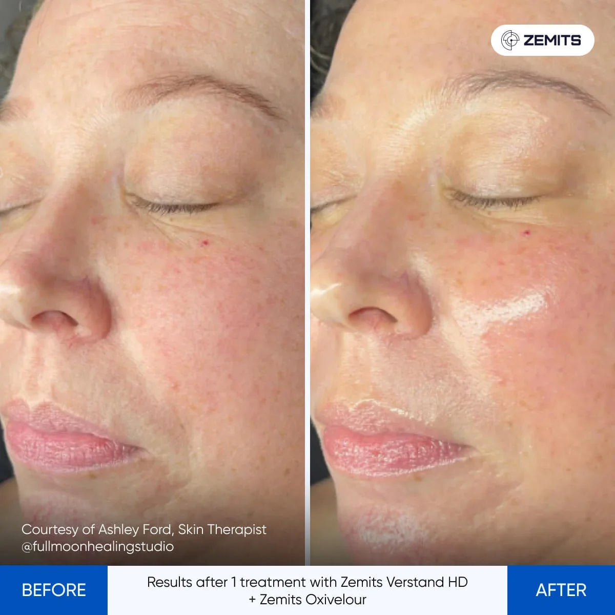 Before After Slide 9