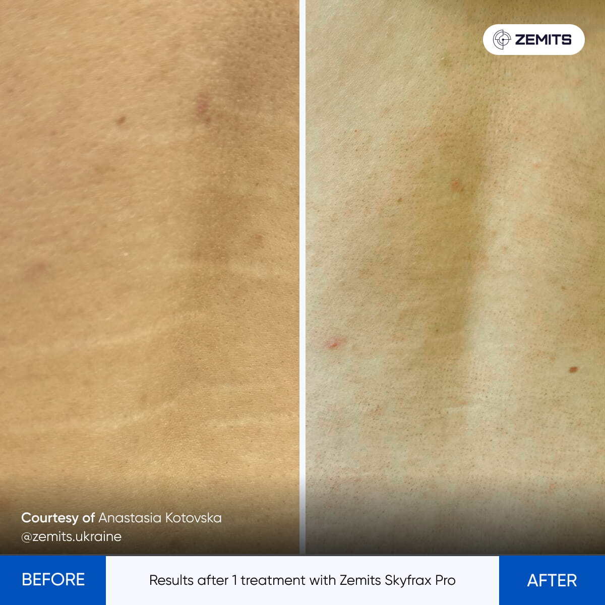 Before After Slide 5