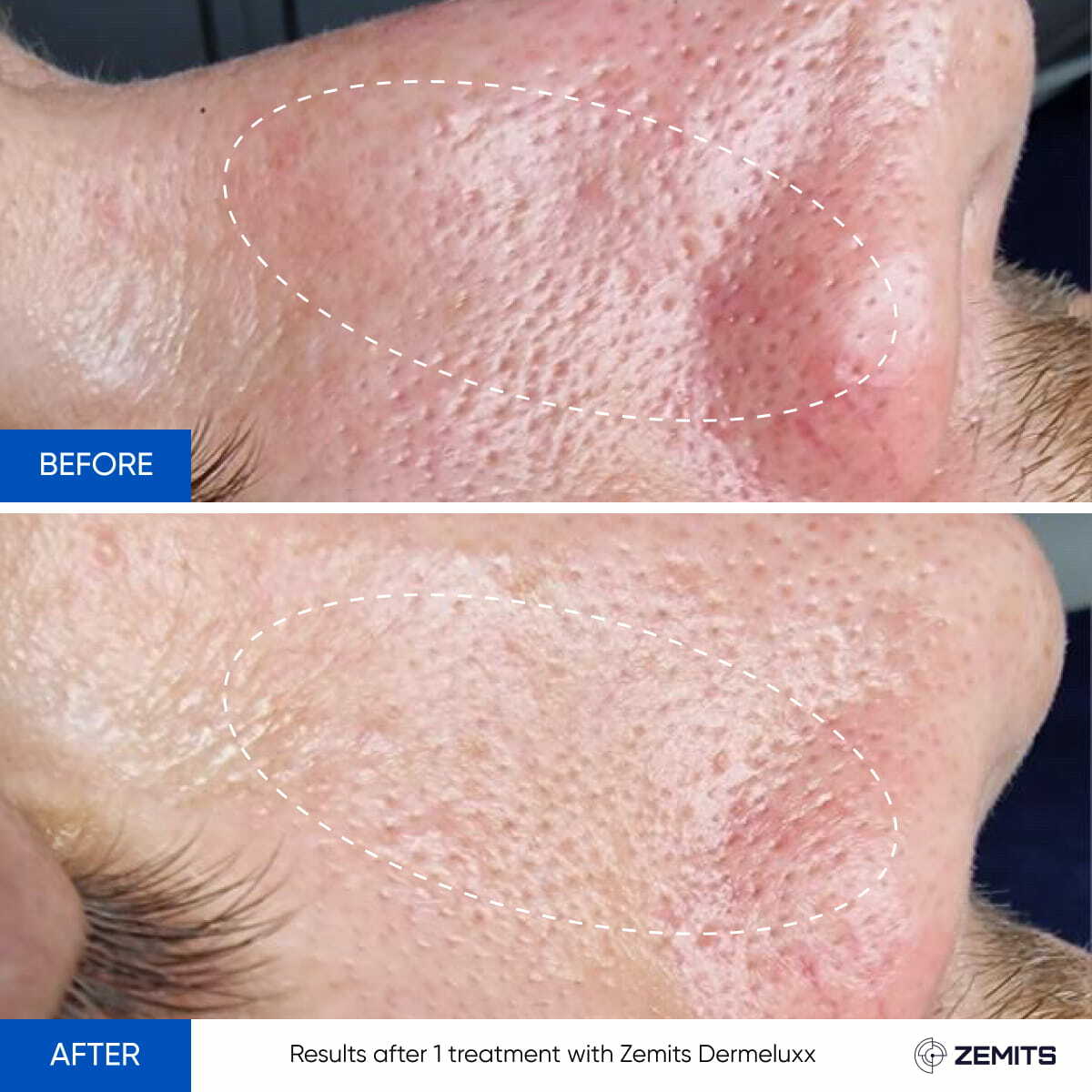 Before After Slide 22