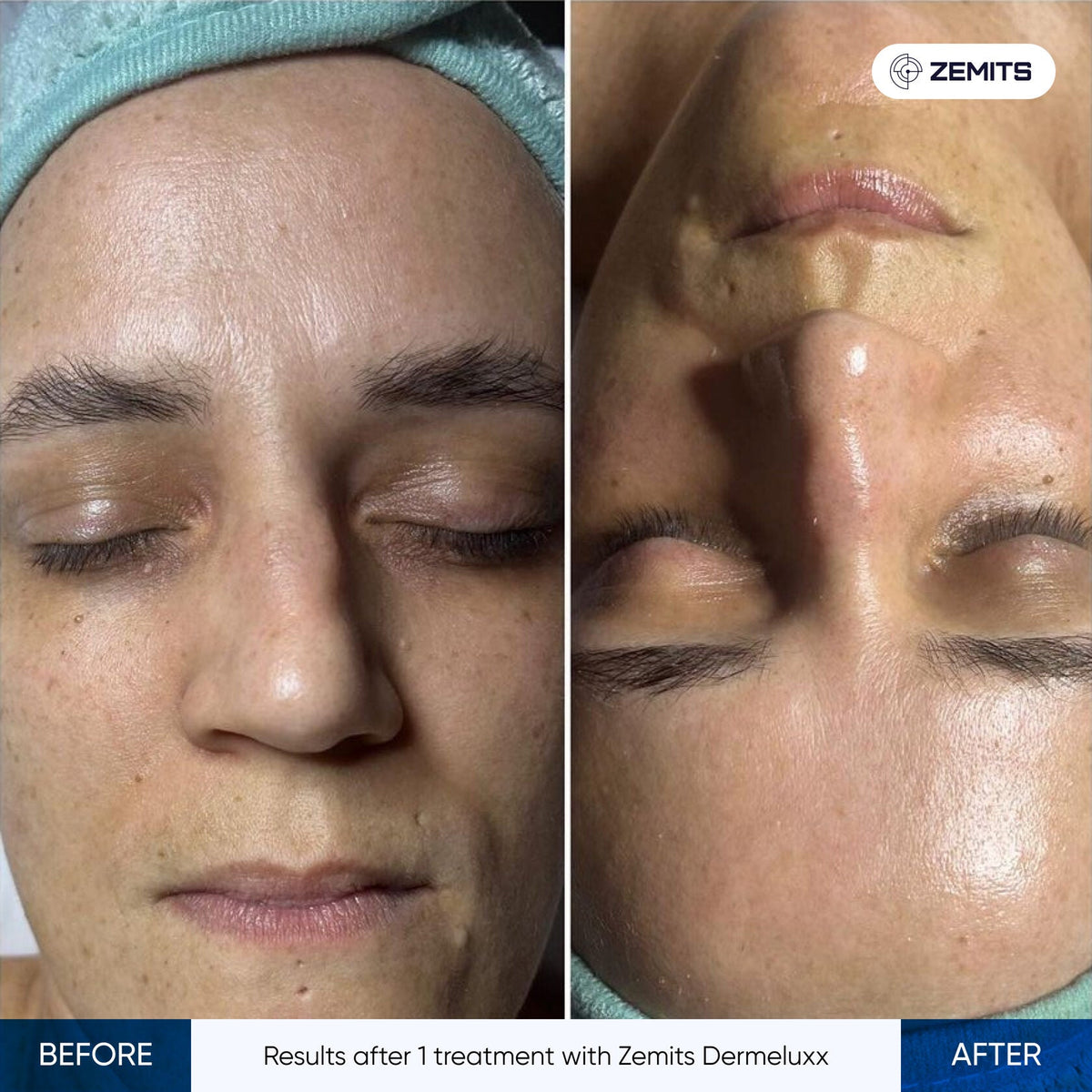 Before After Slide 15