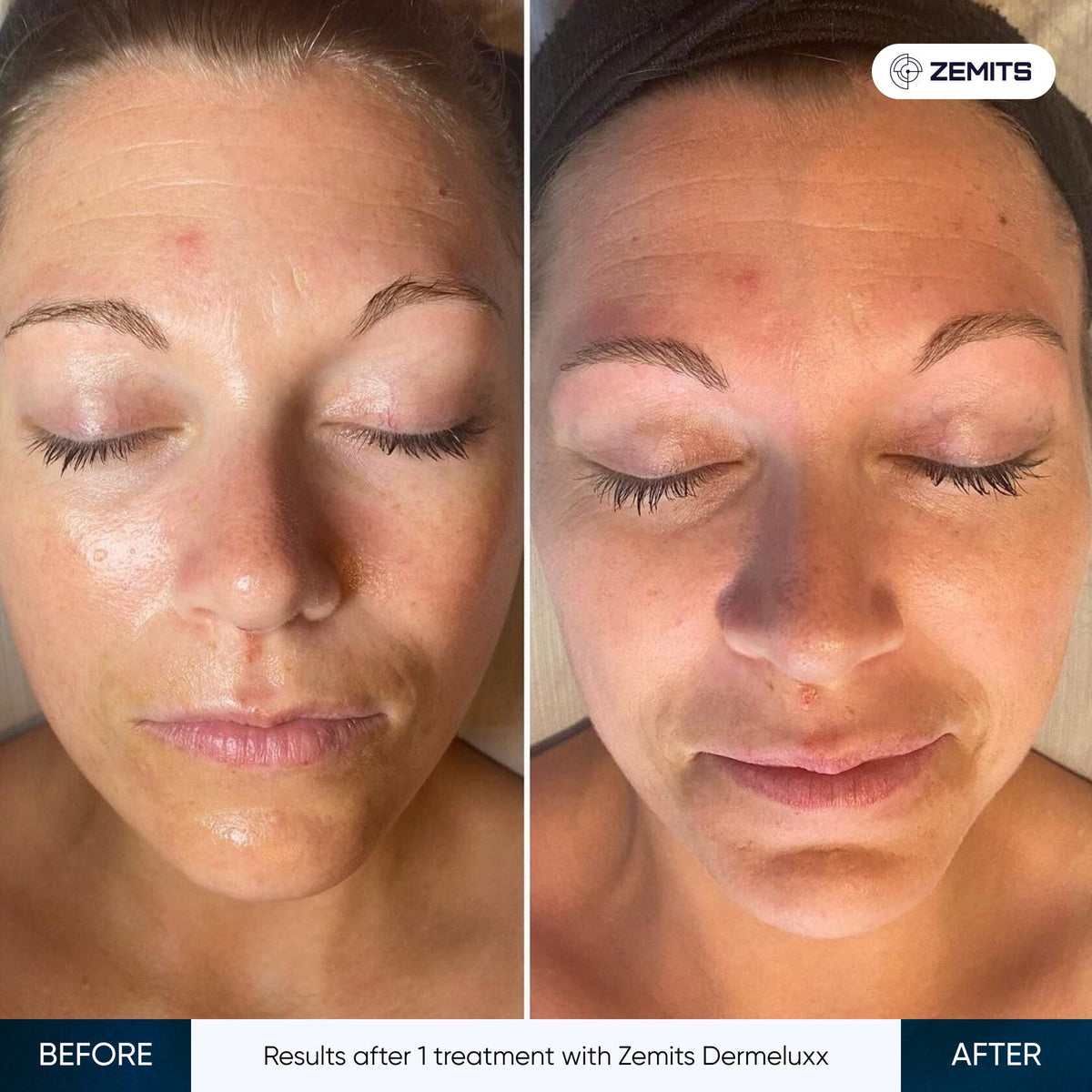 Before After Slide 12