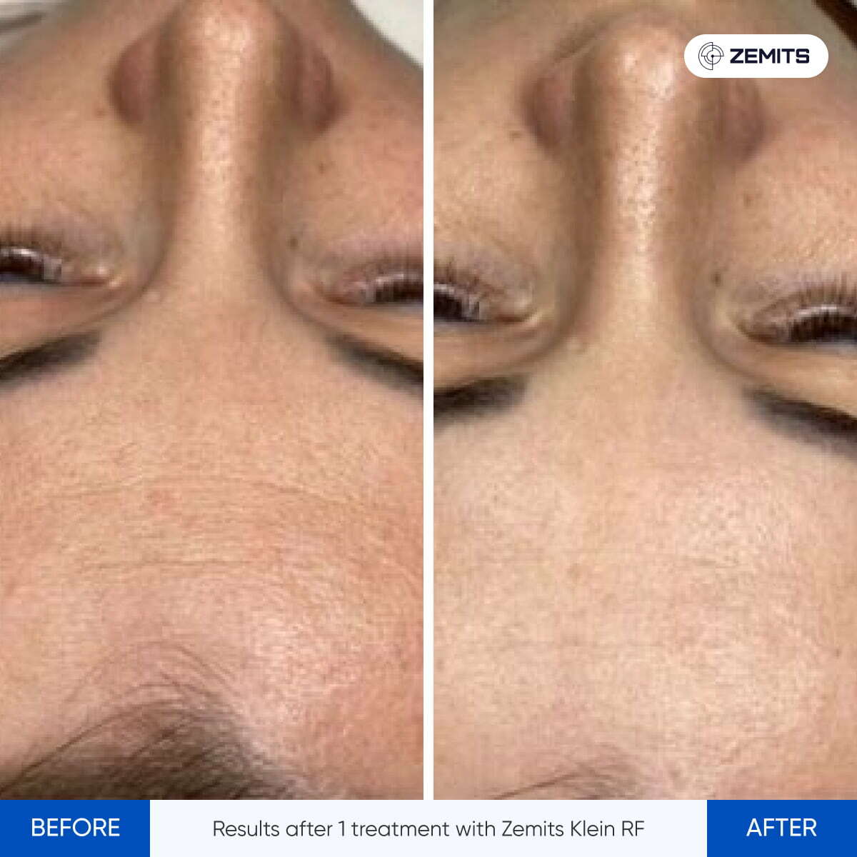 Before After Slide 2