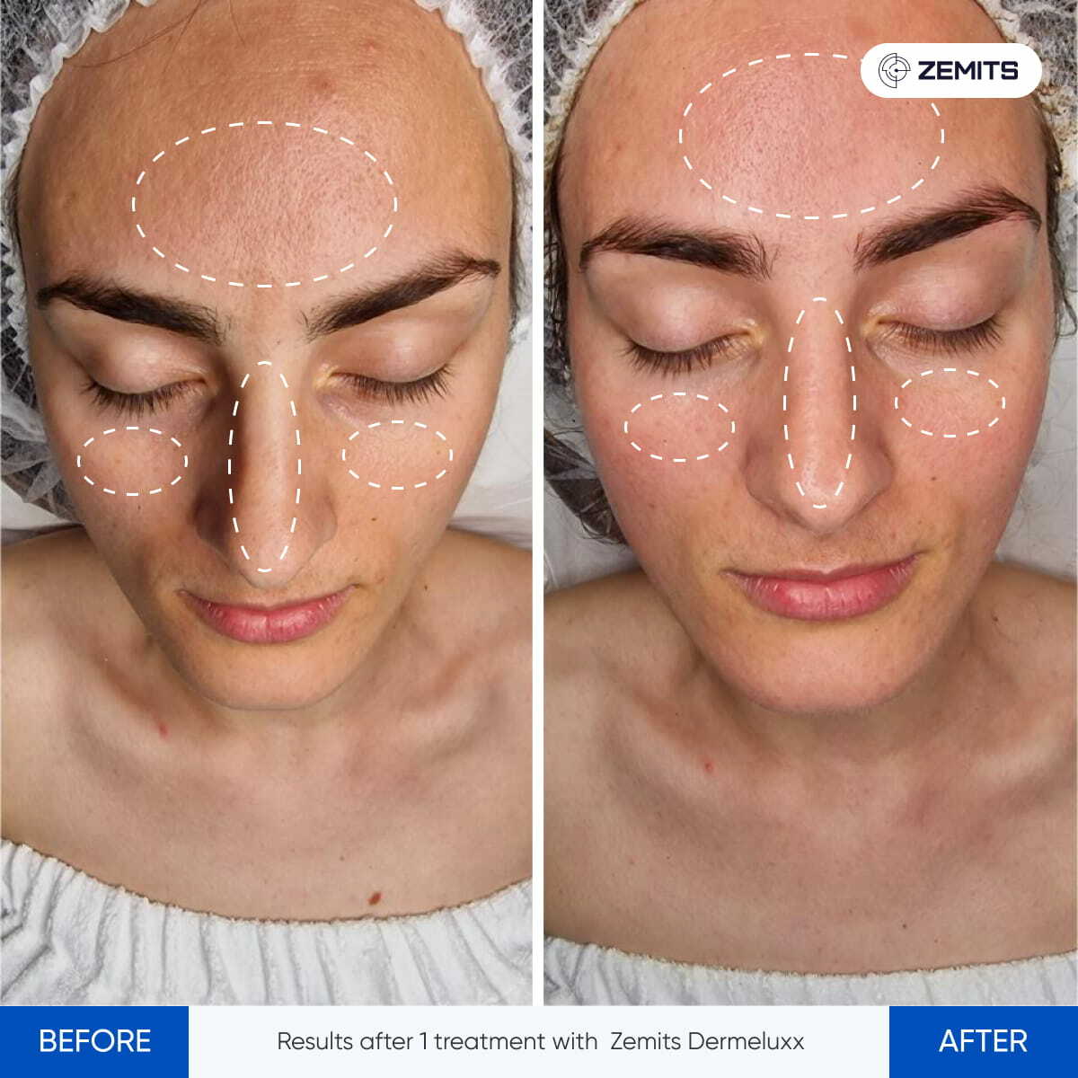 Before After Slide 26