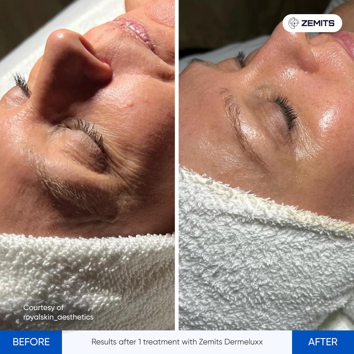 Before After Slide 17
