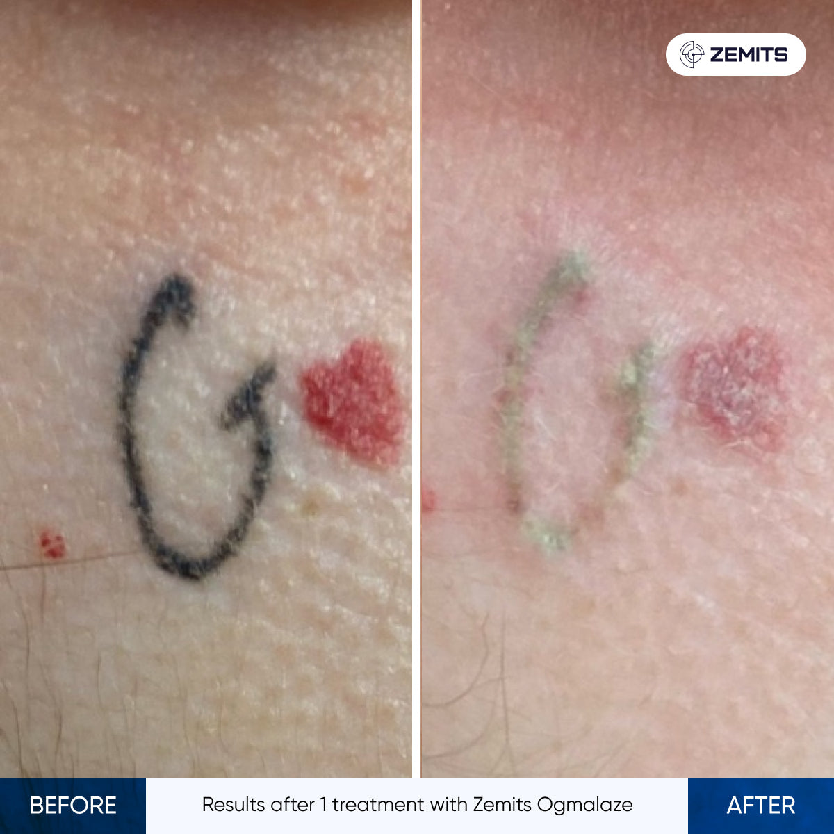 Before After Slide 3