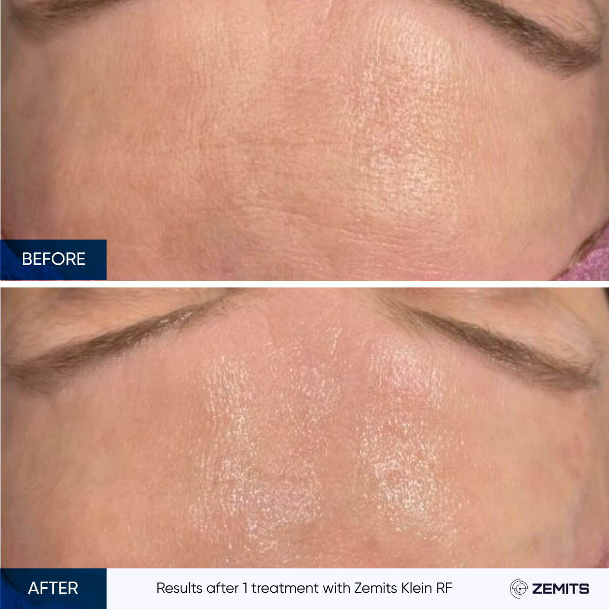 Before After Slide 3