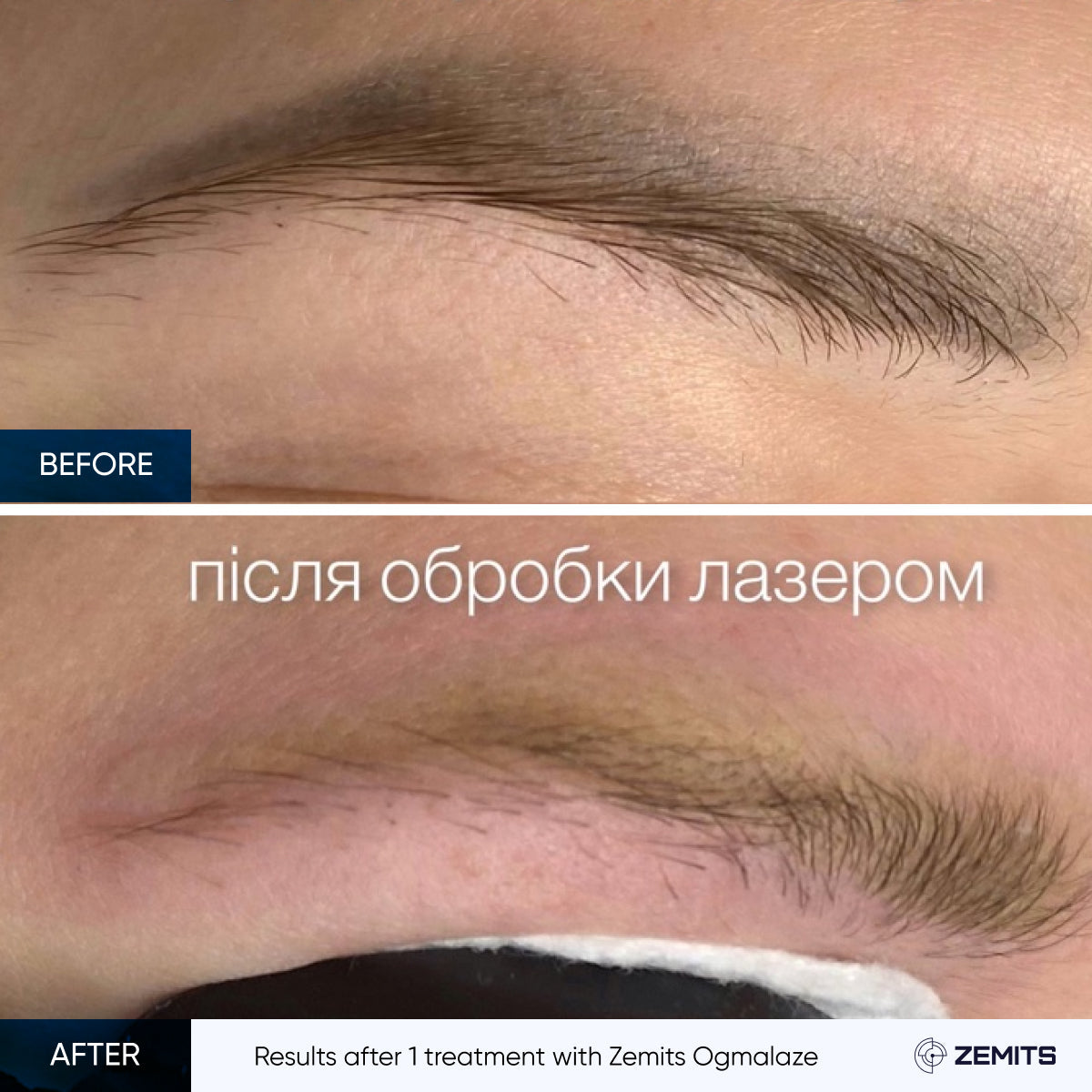 Before After Slide 5