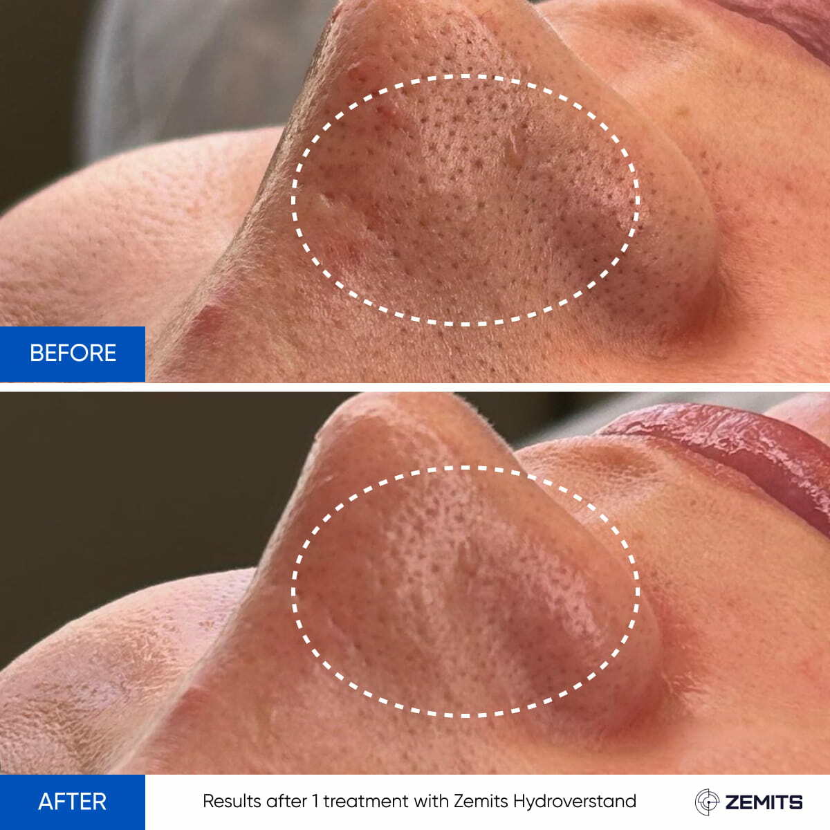 Before After Slide 5