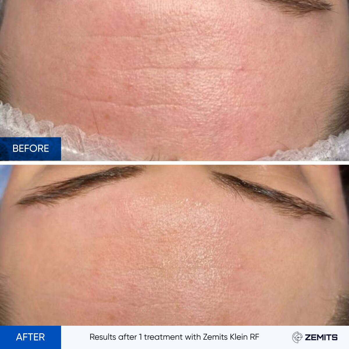 Before After Slide 4