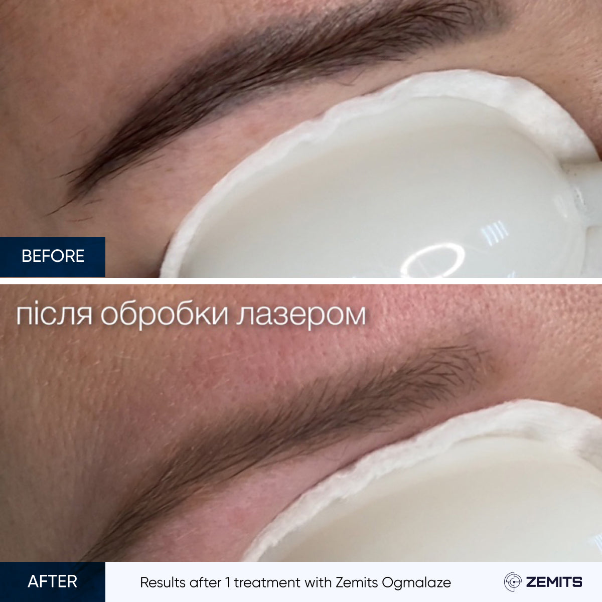 Before After Slide 6