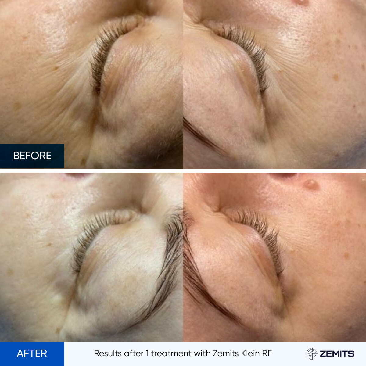 Before After Slide 5