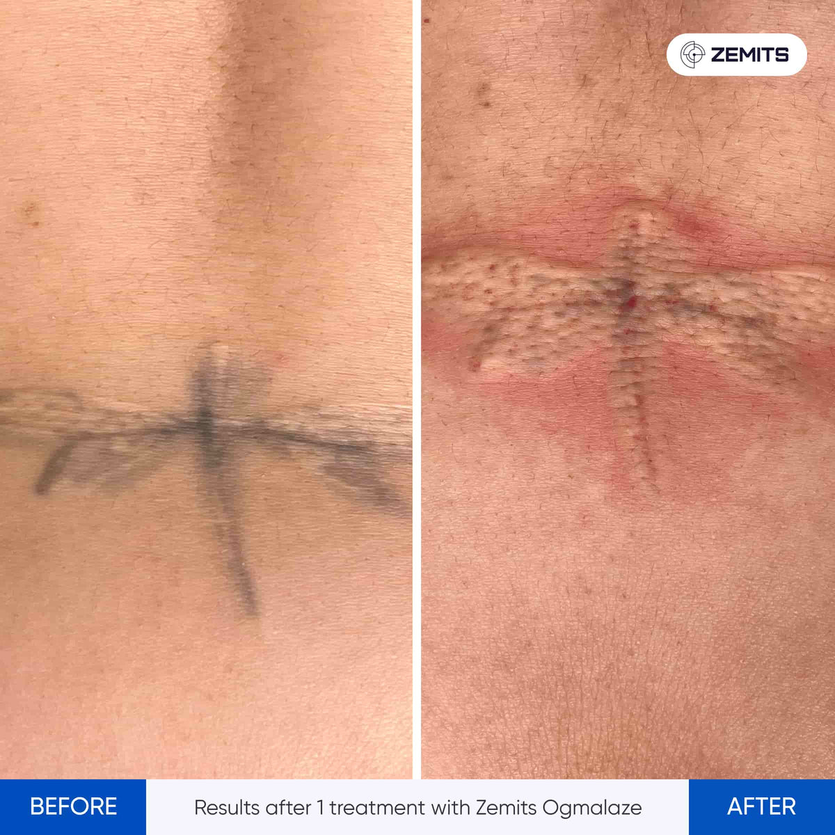 Before After Slide 7