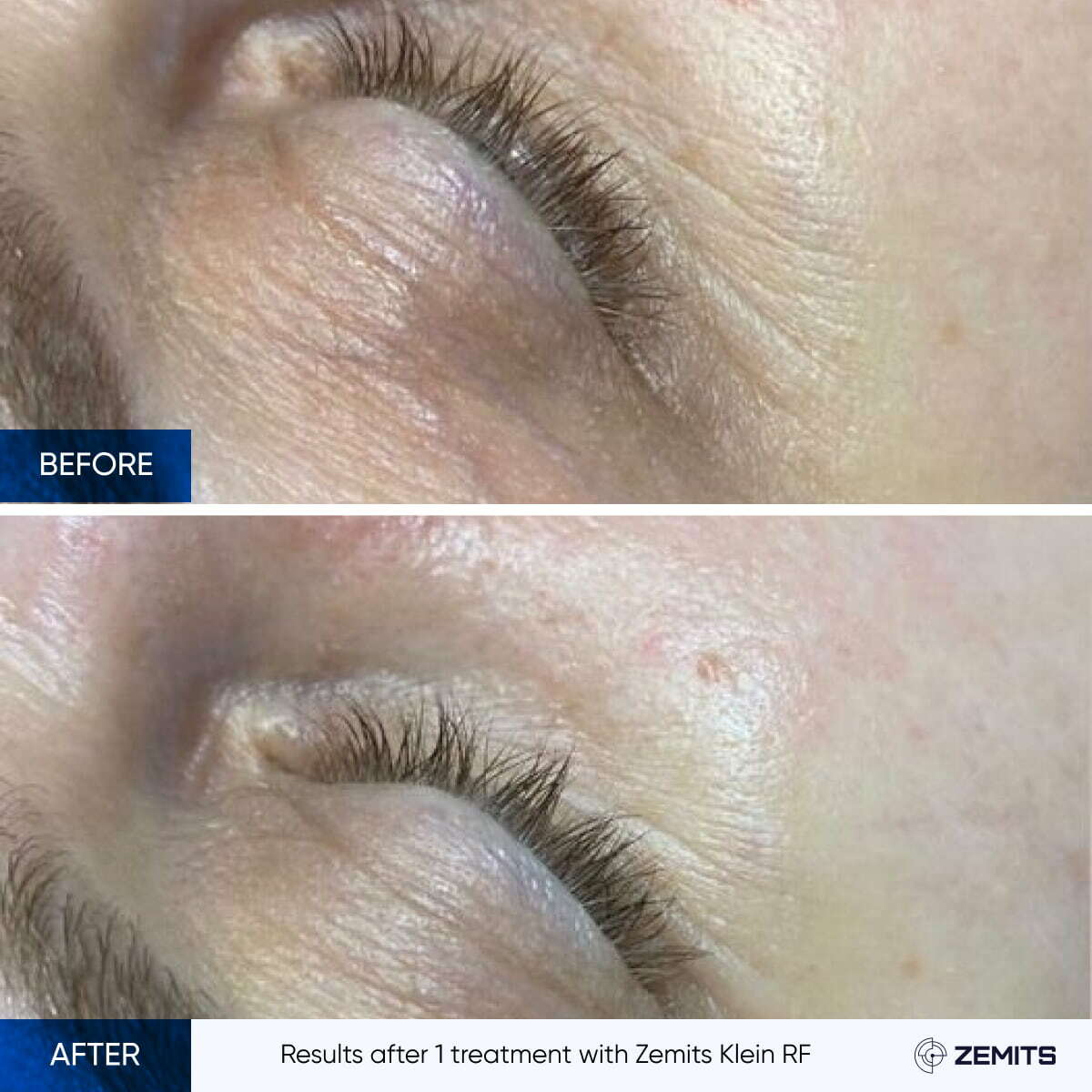 Before After Slide 6