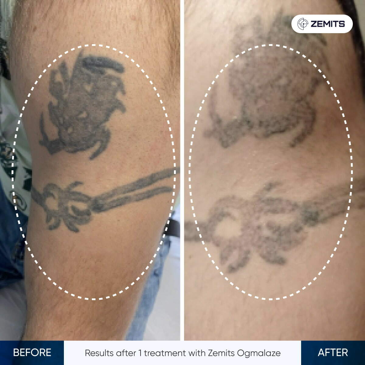 Before After Slide 9