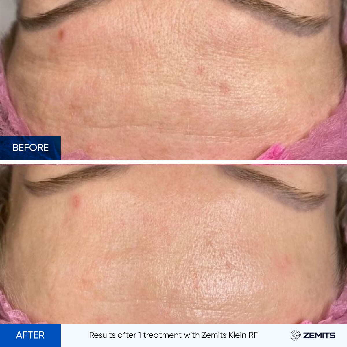 Before After Slide 7