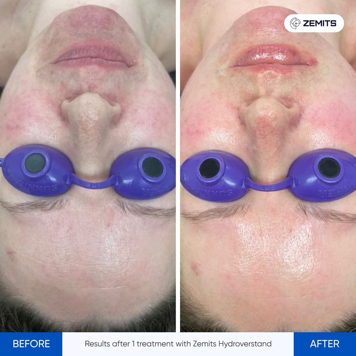 Before After Slide 6