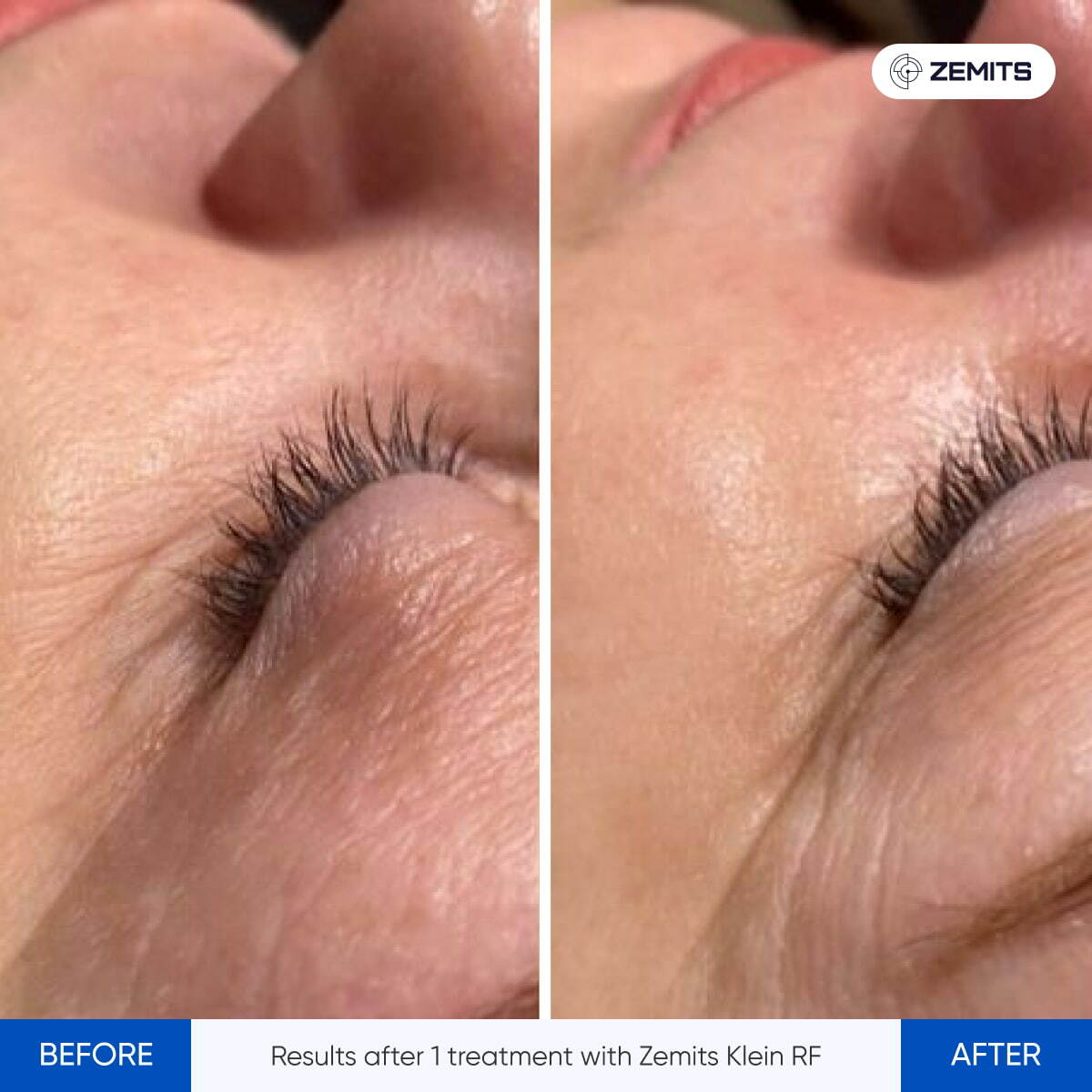 Before After Slide 11