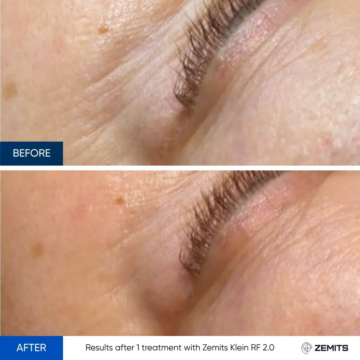 Before After Slide 12