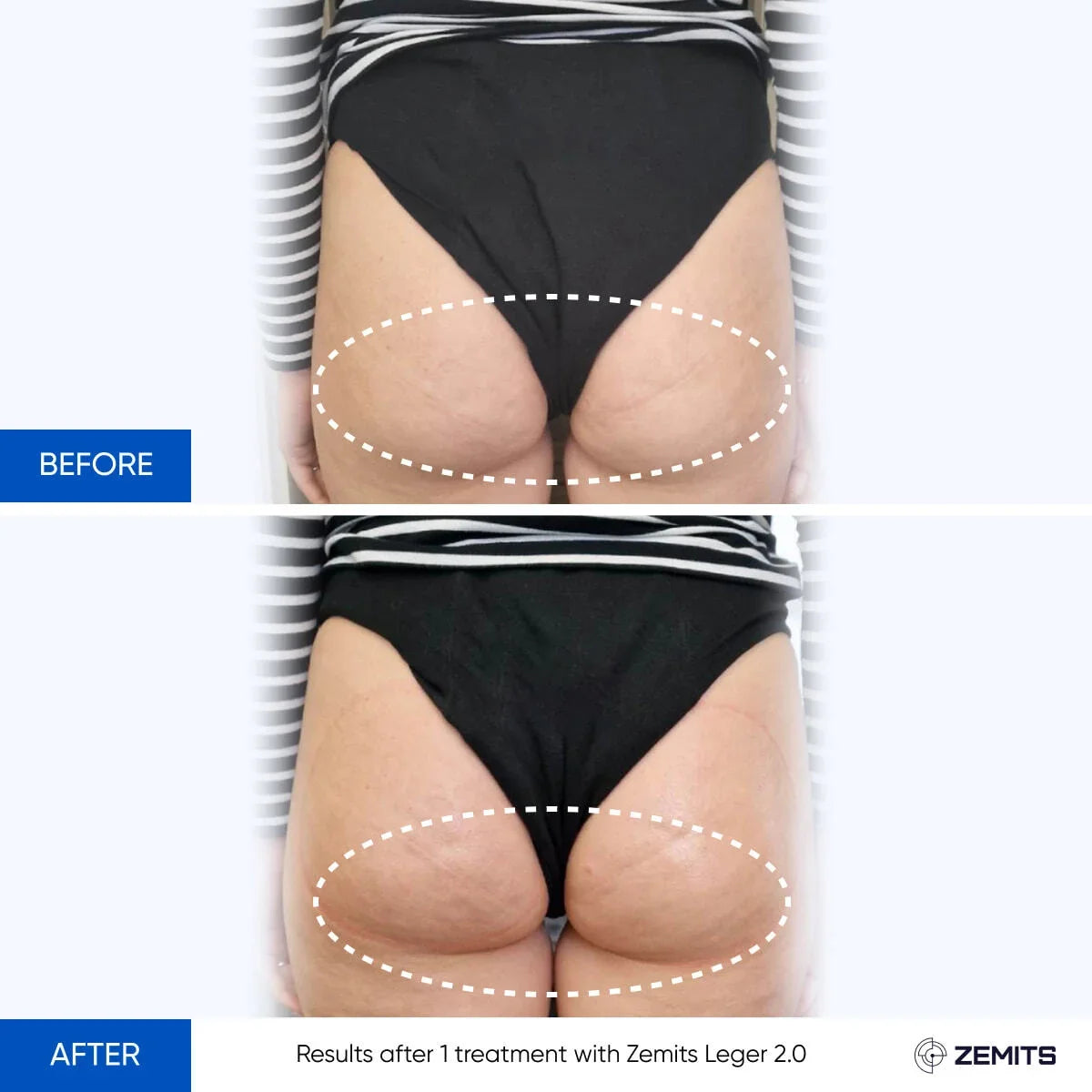 Before After Slide 4
