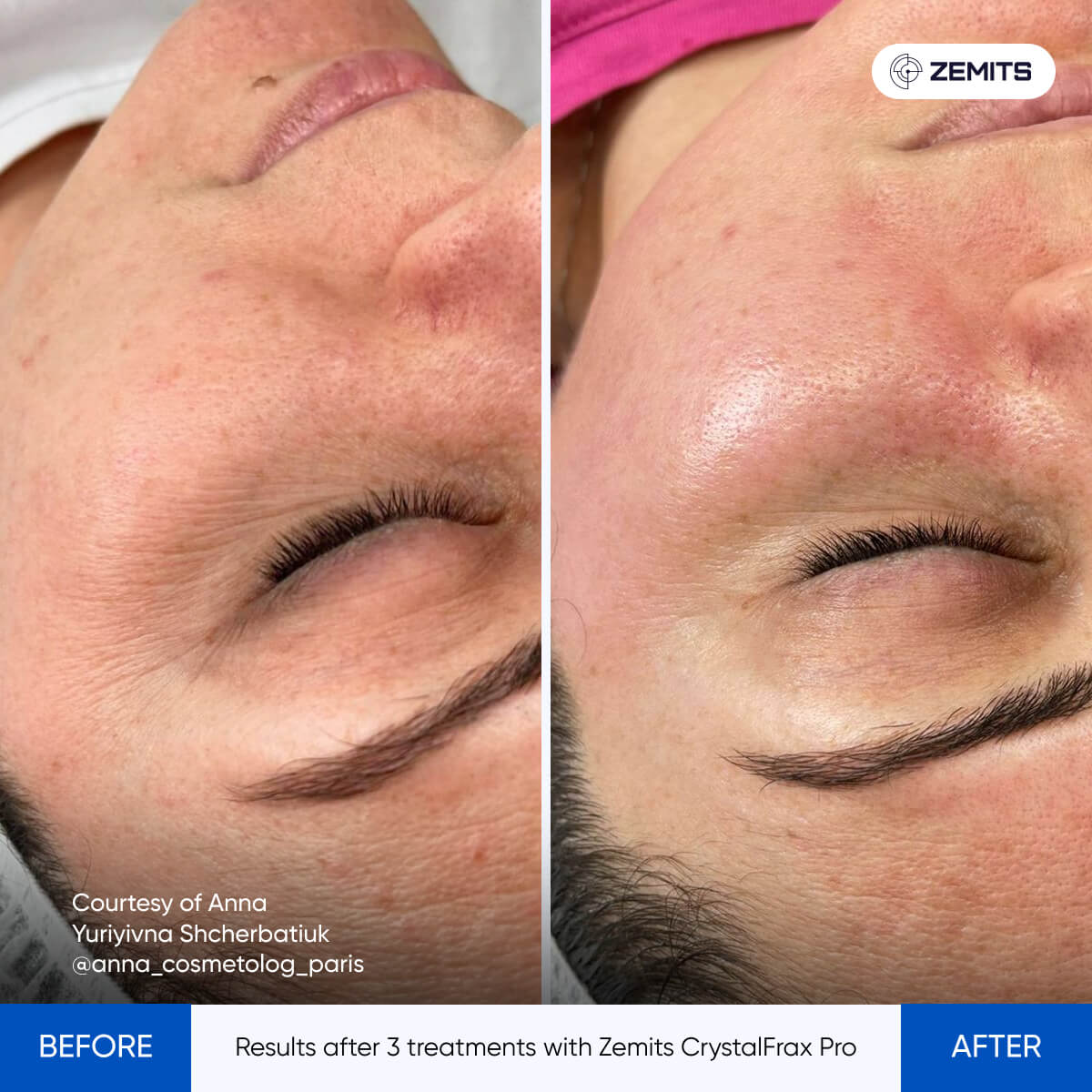 Before After Slide 1