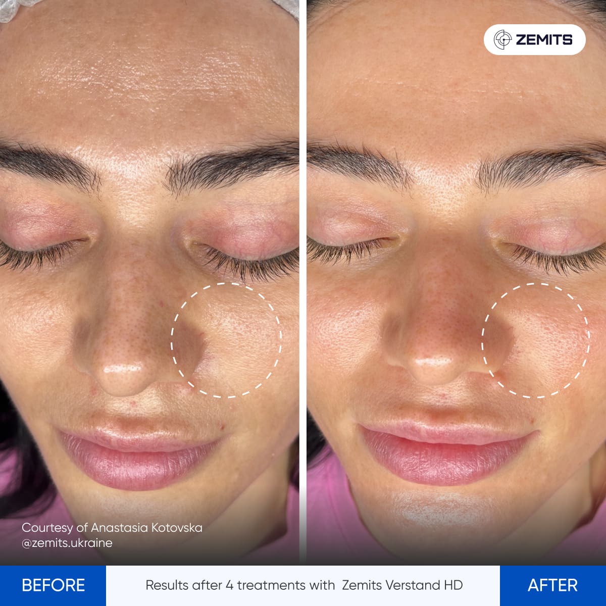Before After Slide 2